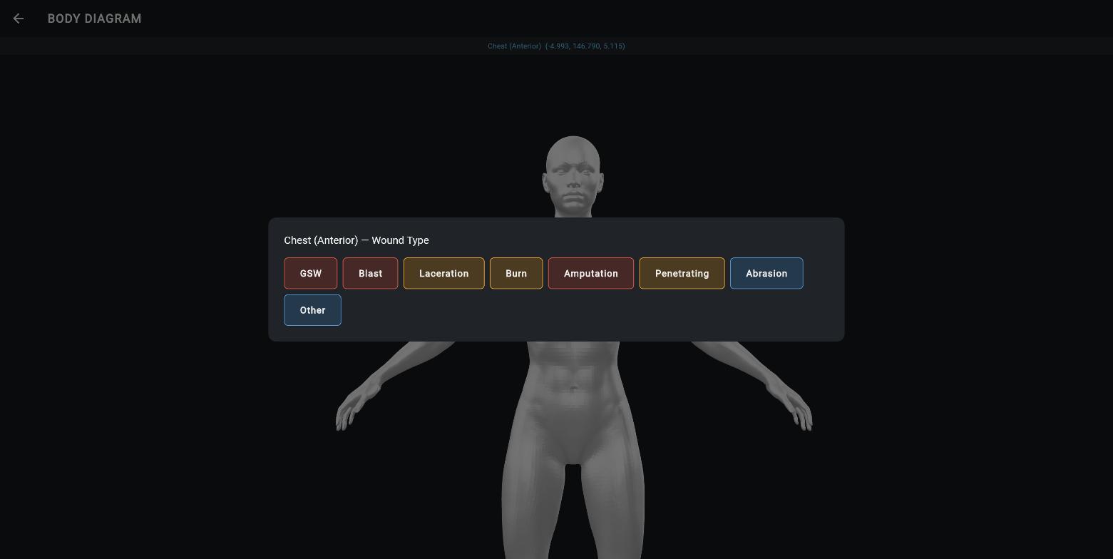 Wound type picker